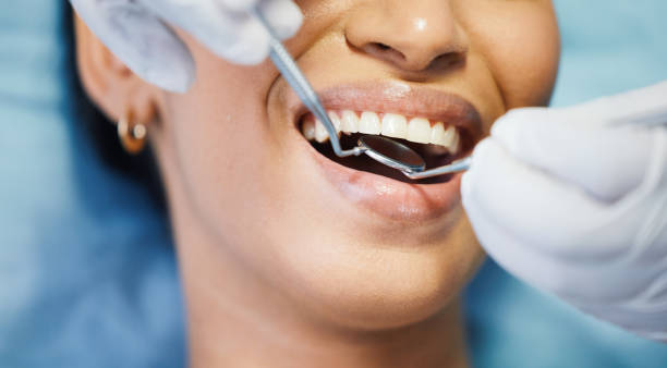 Best Emergency Dental Care for Abscessed Tooth in Eagle, CO